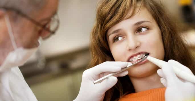Braces