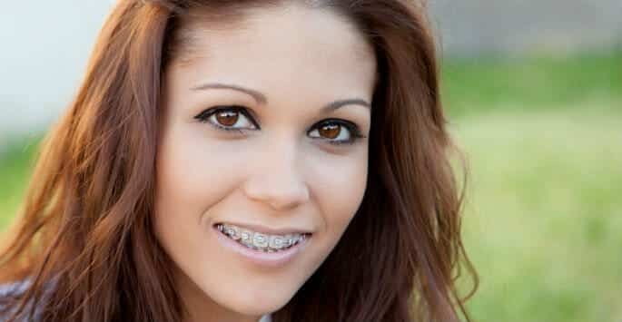 adult braces