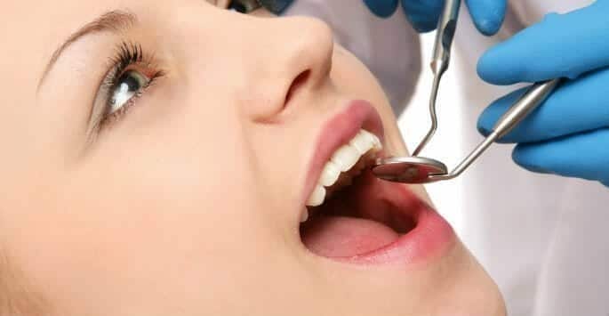 Ceramic Braces