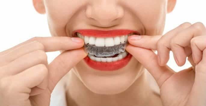 Invisalign®