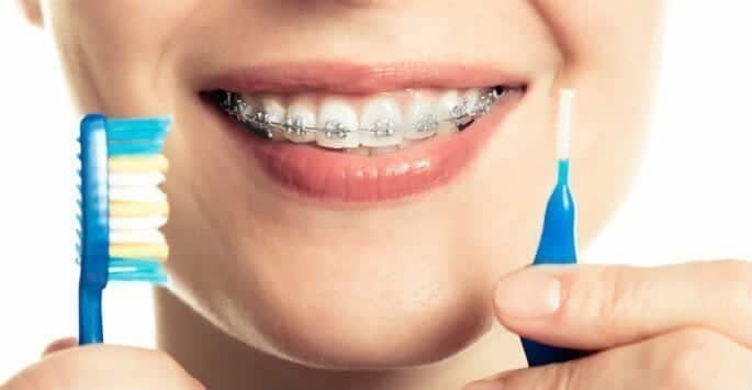 braces