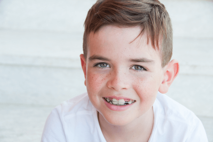 Braces